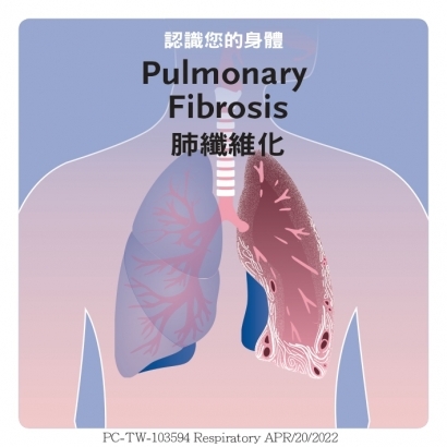 PC-TW-103594 Respiratory OFEV_page-0001.jpg